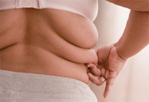 Fat folds to the sides